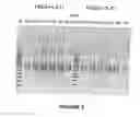 Fig. 06 - Antisense oligonucleotides for inducing exon skipping and methods of use thereof