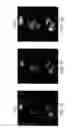 Fig. 05 - Nucleolar targeting of therapeutics against HIV