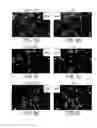Fig. 12 - Nucleolar targeting of therapeutics against HIV