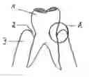 Fig. 01 - Pasty Insert Material for Widening of Gingival Sulcus and Use Thereof