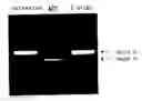Fig. 01 - ENA nucleic acid drugs modifying splicing in mRNA precursor