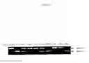 Fig. 03 - ENA nucleic acid drugs modifying splicing in mRNA precursor