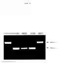 Fig. 07 - ENA nucleic acid drugs modifying splicing in mRNA precursor