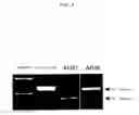Fig. 09 - ENA nucleic acid drugs modifying splicing in mRNA precursor