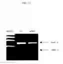 Fig. 17 - ENA nucleic acid drugs modifying splicing in mRNA precursor