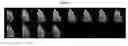 Fig. 08 - Novel Imaging Agents for Detecting Neurological Dysfunction