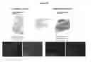 Fig. 12 - Novel Imaging Agents for Detecting Neurological Dysfunction