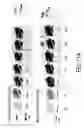 Fig. 13 - Novel Imaging Agents for Detecting Neurological Dysfunction