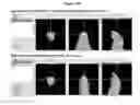 Fig. 22 - Novel Imaging Agents for Detecting Neurological Dysfunction