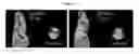 Fig. 23 - Novel Imaging Agents for Detecting Neurological Dysfunction