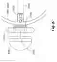 Fig. 33 - Tissue restoration devices, systems, and methods