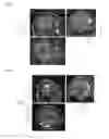 Fig. 05 - METHOD AND AUTOMATED SYSTEM FOR ASSISTING IN THE PROGNOSIS OF ALZHEIMER'S DISEASE, AND METHOD FOR TRAINING SUCH A SYSTEM