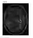 Fig. 06 - METHOD AND AUTOMATED SYSTEM FOR ASSISTING IN THE PROGNOSIS OF ALZHEIMER'S DISEASE, AND METHOD FOR TRAINING SUCH A SYSTEM