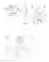 Fig. 04 - Assembly Comprising Inserter, Cannula Part and Base Part