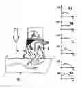 Fig. 01 - METHOD AND MEASUREMENT DEVICE FOR RECORDING MEASUREMENT SIGNALS FROM VITAL TISSUE