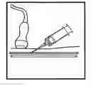 Fig. 01 - Vascular access methods and devices