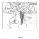 Fig. 03 - Vascular access methods and devices