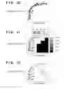 Fig. 08 - Medical image processing apparatus for examining an eye to determine the stage of glaucoma