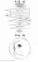 Fig. 10 - Medical image processing apparatus for examining an eye to determine the stage of glaucoma