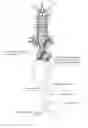 Fig. 01 - METHODS FOR REDUCING TOXICITIES ASSOCIATED WITH MEDICAL PROCEDURES EMPLOYING RADIOGRAPHIC CONTRAST AGENTS