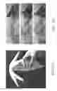 Fig. 03 - Methods, systems, and computer readable media for image guided ablation