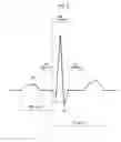 Fig. 06 - ULTRASOUND SYSTEM AND METHOD FOR PROVIDING INFORMATION INDICATIVE OF A CHANGE OF ELASTICITY INFORMATION