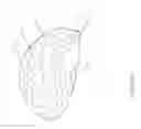 Fig. 02 - Dry electrodes for electroencephalography
