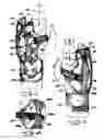 Fig. 02 - Hand brace for immobilizing and adjustably positioning one or more digits