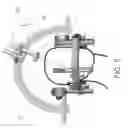 Fig. 08 - Stepped cannula