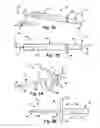 Fig. 02 - Floating spinal cannula and method of use