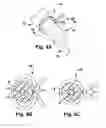 Fig. 04 - Floating spinal cannula and method of use
