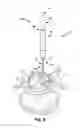 Fig. 07 - Floating spinal cannula and method of use
