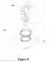 Fig. 08 - Rapid local anesthesia injection cone