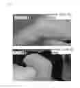 Fig. 06 - Skin patch instrument for treating pain