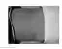 Fig. 08 - Skin patch instrument for treating pain