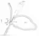Fig. 01 - Occlusion apparatus