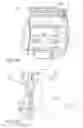 Fig. 07 - Adjustable femoral resection guide