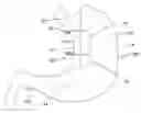 Fig. 01 - Devices, systems and methods for tissue restoration