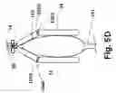 Fig. 11 - Devices, systems and methods for tissue restoration