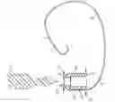 Fig. 01 - SUTURE ASSEMBLY AND SYSTEM