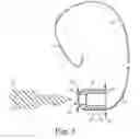 Fig. 03 - SUTURE ASSEMBLY AND SYSTEM