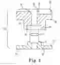 Fig. 04 - SUTURE ASSEMBLY AND SYSTEM