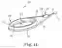 Fig. 16 - SUTURE ASSEMBLY AND SYSTEM