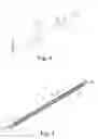 Fig. 04 - Tissue suturing method