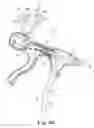 Fig. 11 - Tissue suturing method