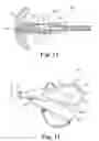 Fig. 13 - Tissue suturing method