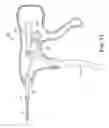 Fig. 14 - Tissue suturing method
