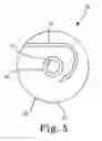 Fig. 07 - Suture assembly and system