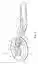 Fig. 09 - Suture assembly and system