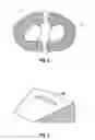 Fig. 03 - Method and apparatus for meniscal repair